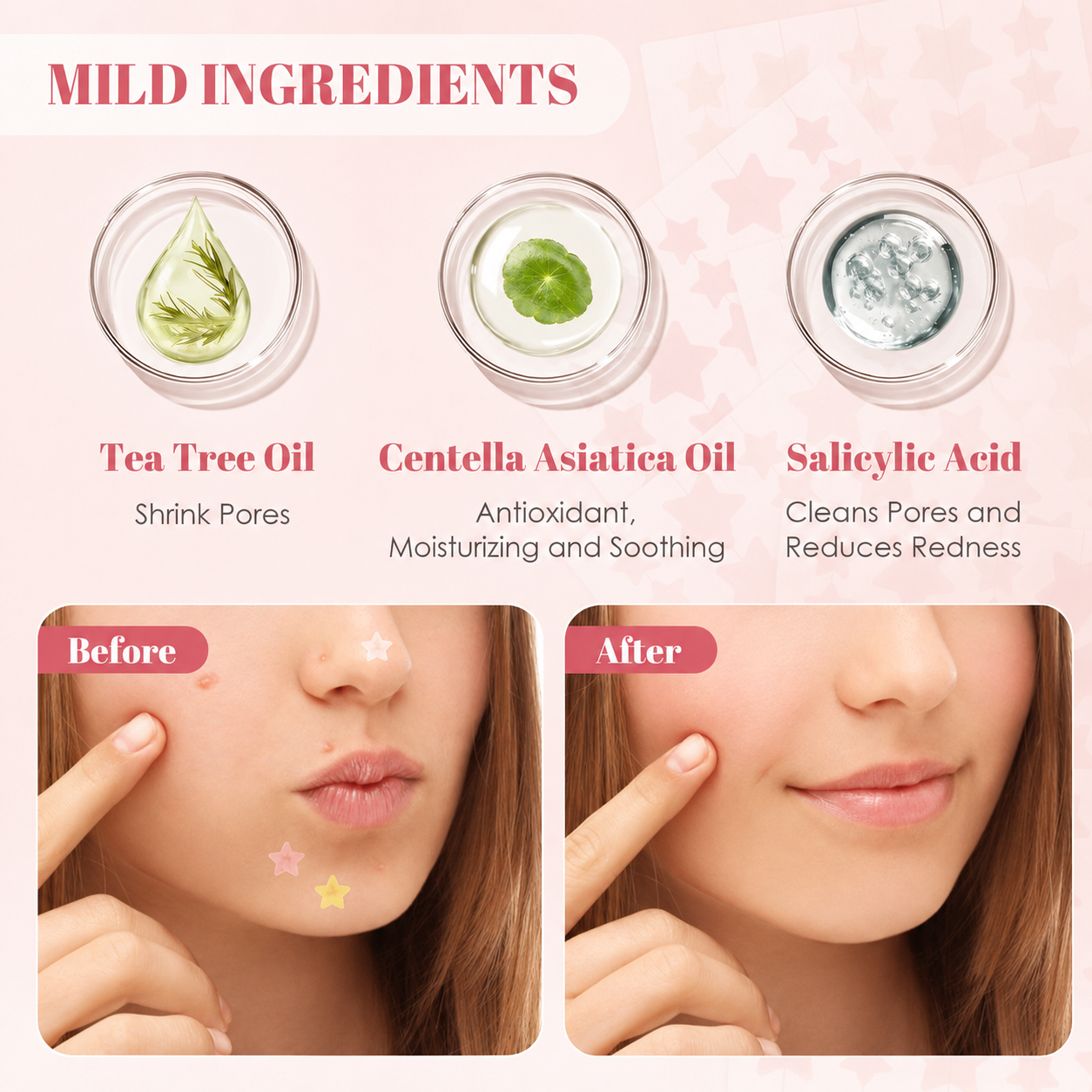 Pimple patch ingredients and results